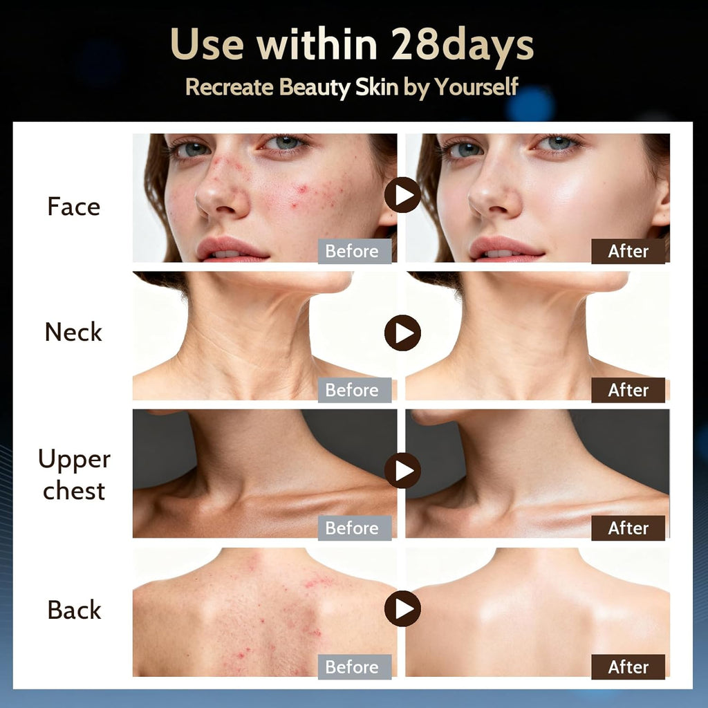 LumiGlow Pro — Advanced Red Light Therapy Facial Mask